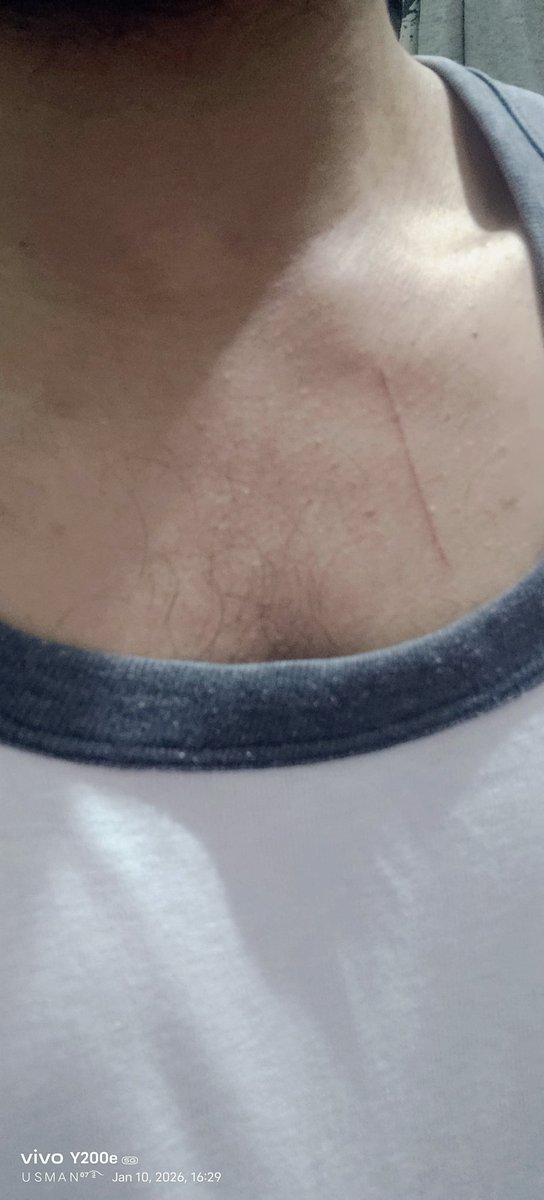 RoyceUsman's tweet photo. Cat Kitten killed me 🎀🤍✨🥹 https://t.co/8724PPNnmj