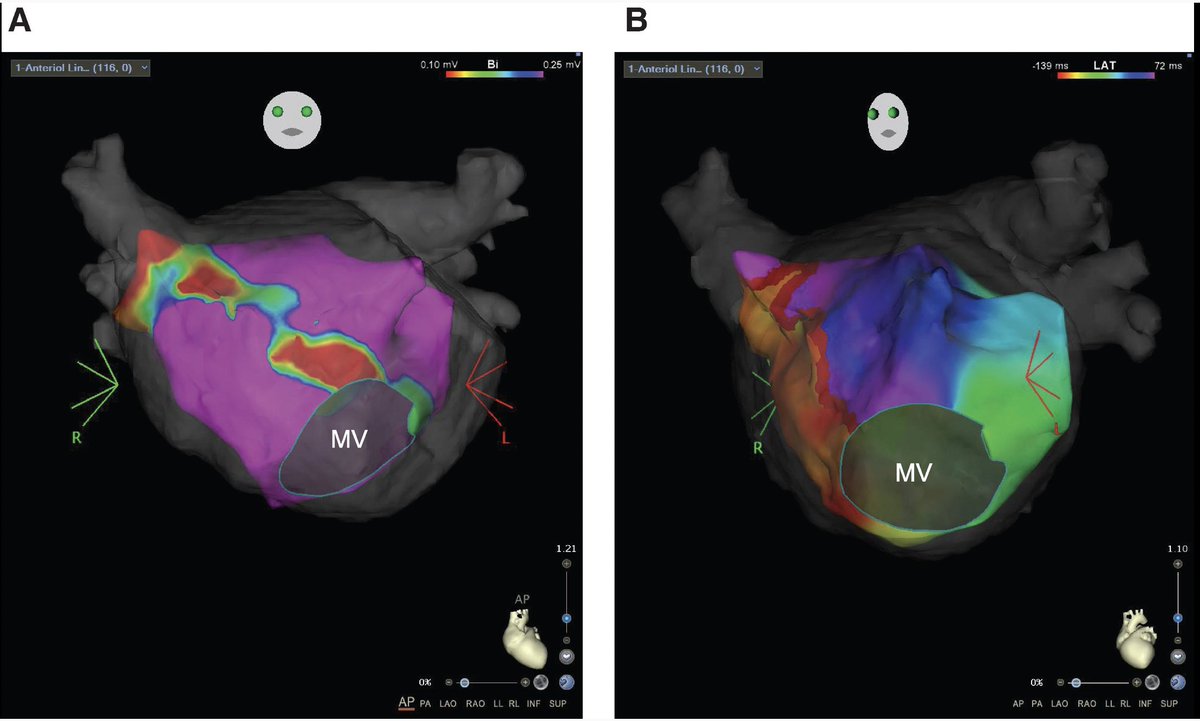European Society of Cardiology Journals tweet media