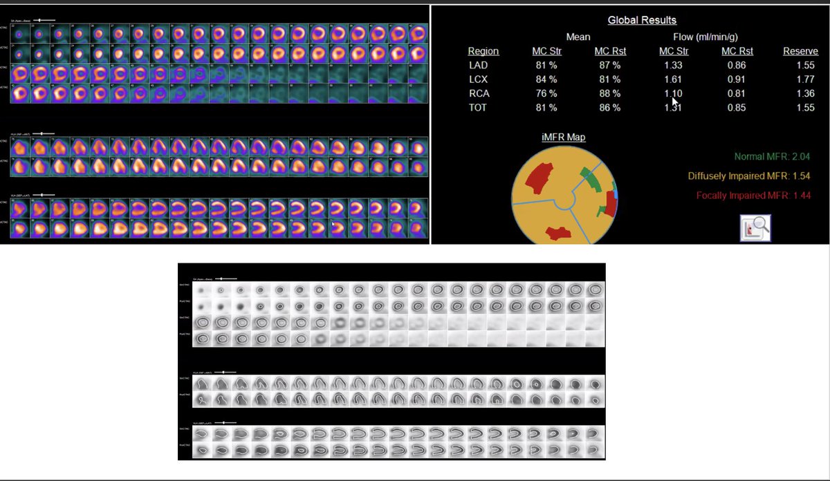 A.Sami Abuzaid MD,EMHL,FASE,FSCCT,FSCMR,FESC,FACC tweet media