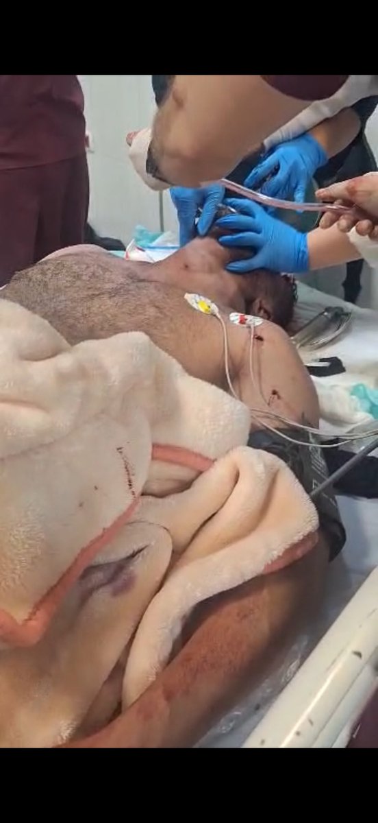 Besonders alarmierend: Mindestens 400 Demonstrierende wurden gezielt am Auge verletzt. Augenzeugen berichten von schweren Kopf- und Halsverletzungen. Videos zeigen die Leichen der Protestierenden in Krankenhäusern und Leichenhallen, was die massive Gewalt gegen die Demonstranten