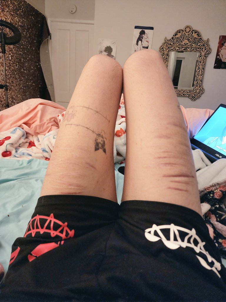 puppystarves's tweet image. "i wish I didnt have these scars on me so I could look normal in shorts &amp;amp; at the beach"
vs
"the fact that these scars are fading makes me feel like i'm losing something important to my identity"