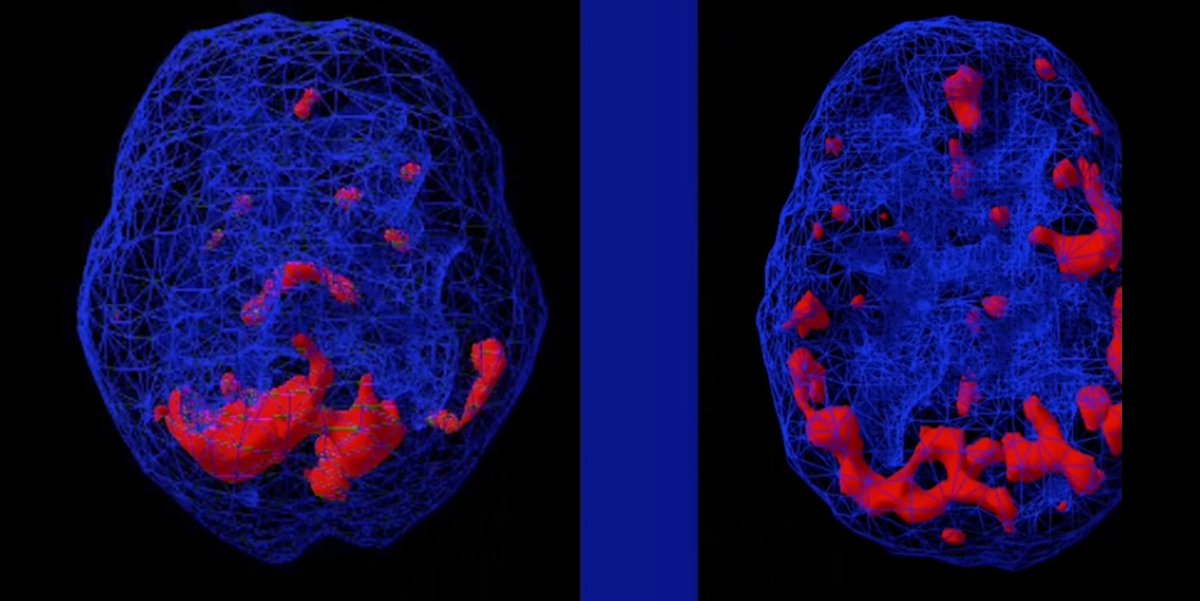 لاتعطي ( الفراغ ) فرصه ...🙏

أكثر مايهاجمك وقت الفراغ : 
- أفكار الماضي 
- أفكار المستقبل
- الأفكار الآليه السلببه الحاليه

⛔️ أحذر 
هناك أكثر من مليار خليه في الدماغ تكون أكثر إنشغال بأحداث الحياه المختلفه ، لذلك قد يكون هناك ( استنزاف ) لمركز الذاكره الحصين والقشره الجبهيه