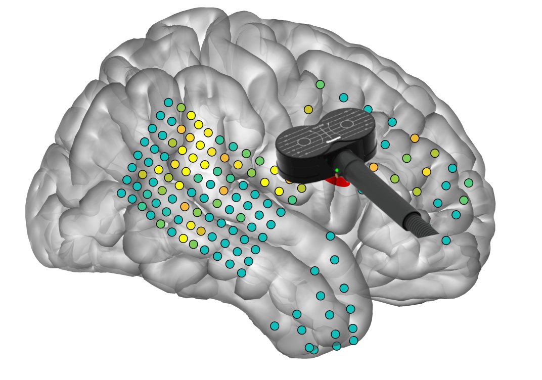 Brain1878's tweet photo. Tsang et al. reviewed 13 studies combining TMS with intracranial EEG in humans and non-human primates. They found that stimulation can rapidly alter neuronal activity and connectivity, with some effects persisting for extended periods. https://t.co/3cvW3JzJep https://t.co/iJkdn3vshT