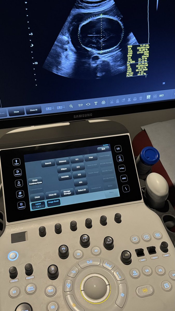 Random so far 
Intern 25-26