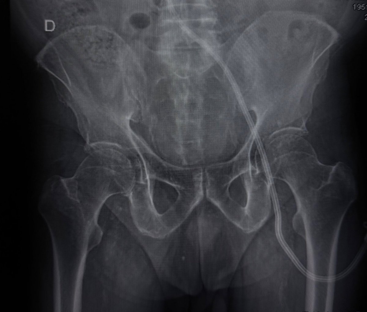 MEDzquino tweet media