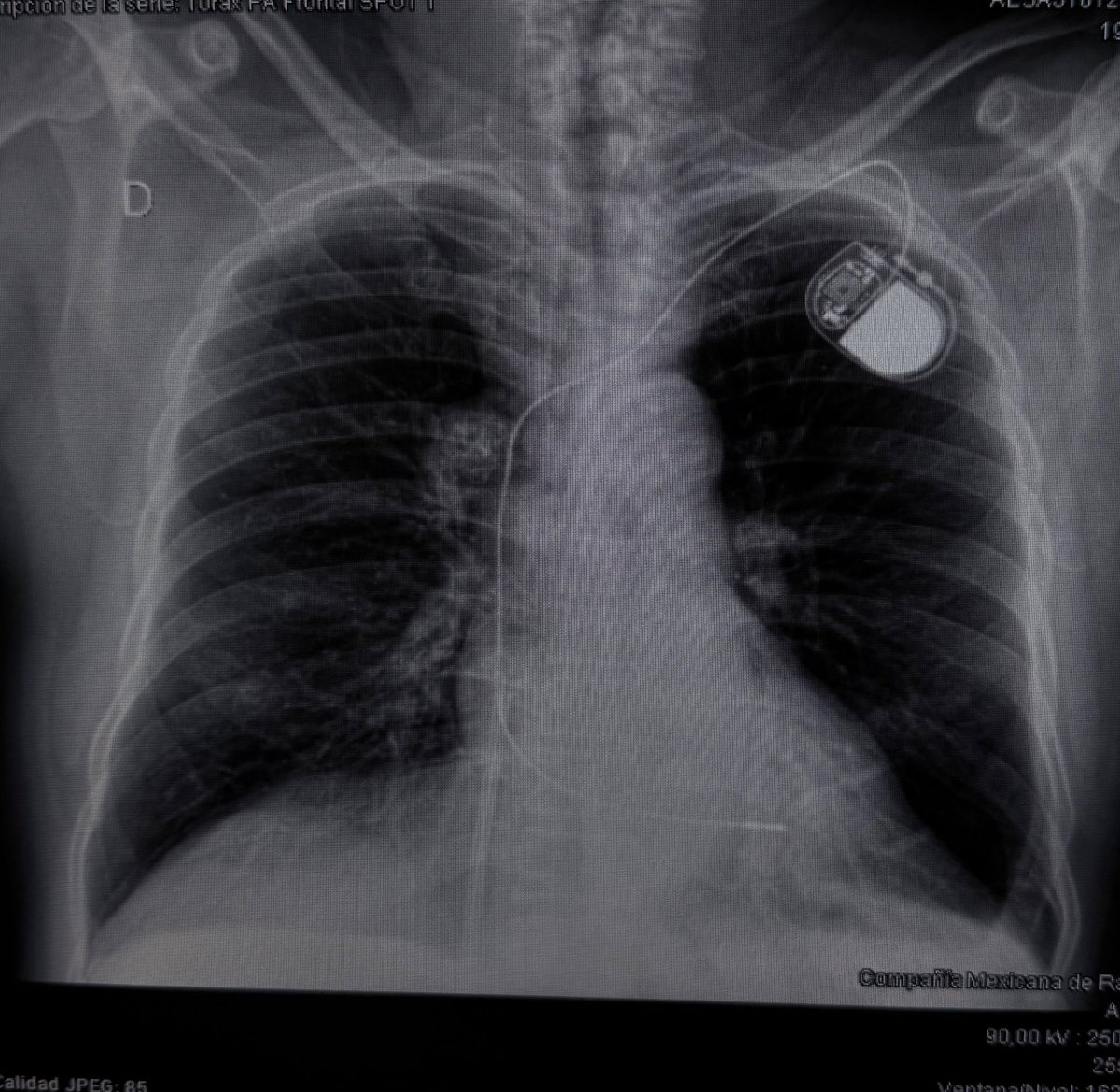 MEDzquino tweet media