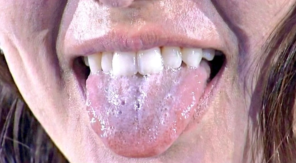 hatotsuba's tweet photo. AIって恐ろしい。
1枚目は元画像を高画質化したもの。
#唾糸　#saliva
#舌　#tongue
#歯　#teeth
#口フェチ https://t.co/10s6ns8EZX