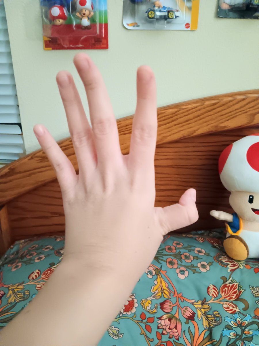 BrunAmitie's tweet image. as a person born w/ double-jointed thumbs myself, it honestly baffles me how quick ppl are to assume an image is gen ai just because a person bends their joints in a way they're not used to

y'all need to do your research before spreading stuff like that first