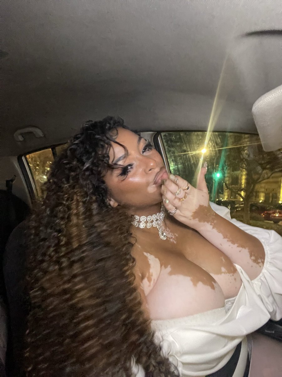 JanayProspers's tweet photo. Caption this so I don’t have to 🦋
#vitiligobaddie #Nay #janayprospers https://t.co/slvxl8fj8J