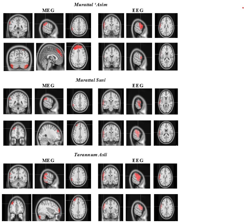 NeuroResNotes's tweet image. Rhythmic Quranic recitation synchronizes high-frequency gamma brainwaves across language, music, emotion, memory, and attention networks—engaging the brain similarly in Muslim and Quran-naïve non-Muslim listeners, even without understanding Arabic. neuroscirn.org/ojs/index.php/…