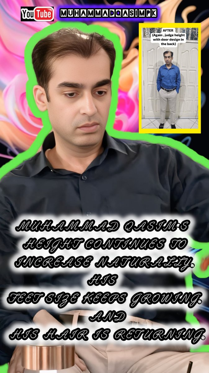 Hair returning reflects mercy unfolding. Muhammad Qasim. 
<a href="/RTErdogan/">Recep Tayyip Erdoğan</a> <a href="/CMShehbaz/">Shehbaz Sharif</a> <a href="/ForeignOfficePk/">Ministry of Foreign Affairs - Pakistan</a> <a href="/GovtofPakistan/">Government of Pakistan</a> <a href="/prabowo/">Prabowo Subianto</a>