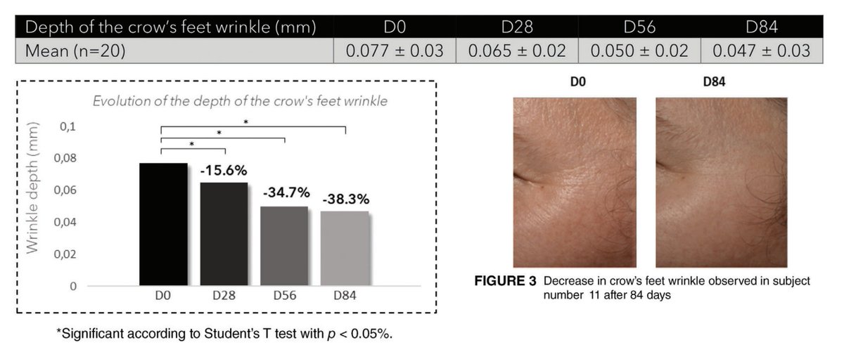 Red light therapy reversed all signs of skin aging &amp; disease in a clinical study.

12 minutes 2x weekly improved:

◈ Wrinkle depth by ~38%
◈ Sagging by ~25%
◈ Elasticity by ~20%
◈ Roughness by ~25%
◈ Complexion uniformity by ~35%
◈ Pore size by ~1/3
◈ Sebum production by