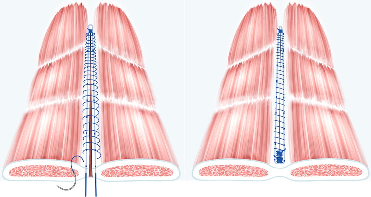 BJS Open tweet media