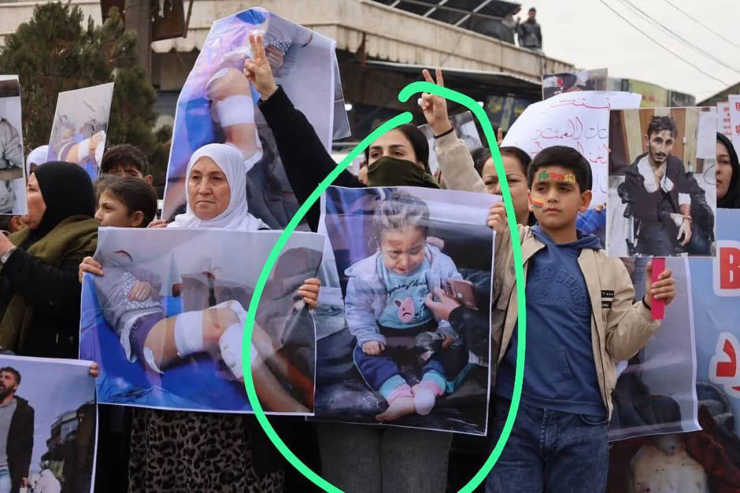 من مظاهرة انصار قسد في ريف الحسكة اليوم

حيث حمل المشاركون صورة الفتاة الحلبية التي أصيبت وفقدت بصرها جراء قذائف الهاون التي أطلقتها قسد على مدينة حلب.