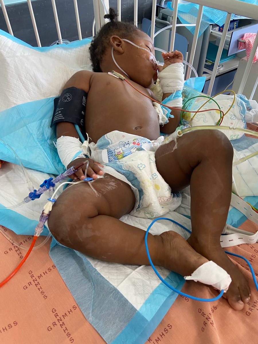 sara_alexia's tweet image. Eliete is diagnosed with cancer for the second time at 2 years old only and she's fighting for her life, Please consider donating or reposting so she gets the surgery and treatment she needs and please pray for her.💔

DONATE👉 givesendgo.com/GHW27?utm_sour

Thank you for your kindness…