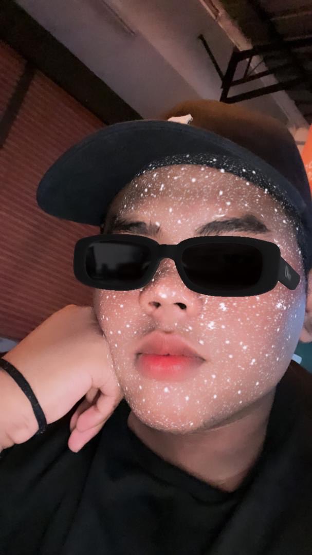 Bibir besar tak boleh nak buat ape dah erm HAHA 😔🙏🏽