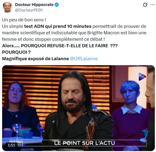 Un test ADN de 10 minutes permettrait de prouver de manière scientifique et indiscutable que Francis Lalanne n'est pas un crapaud buffle, pourquoi refuse-t-il de le faire ?