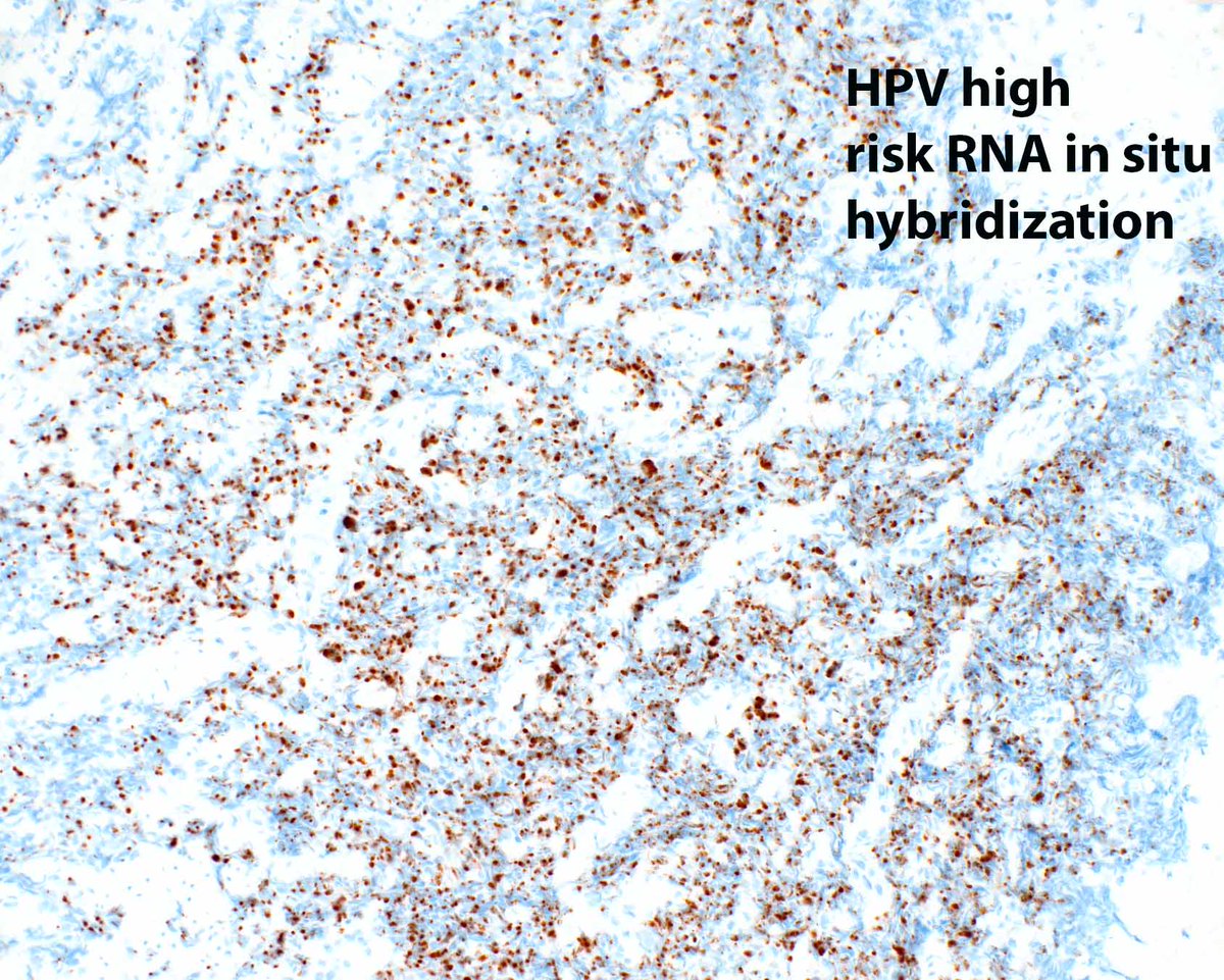 Modern Pathology tweet media