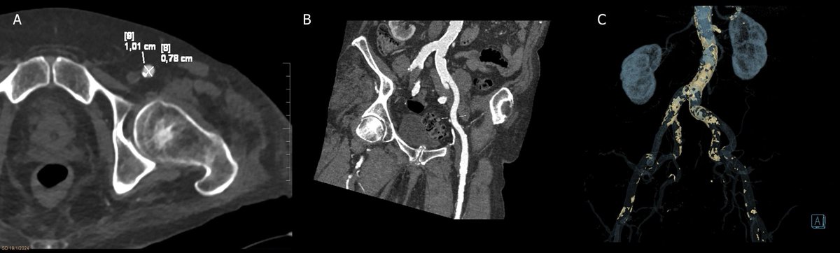 @RevistaRADIOLOGIA tweet media