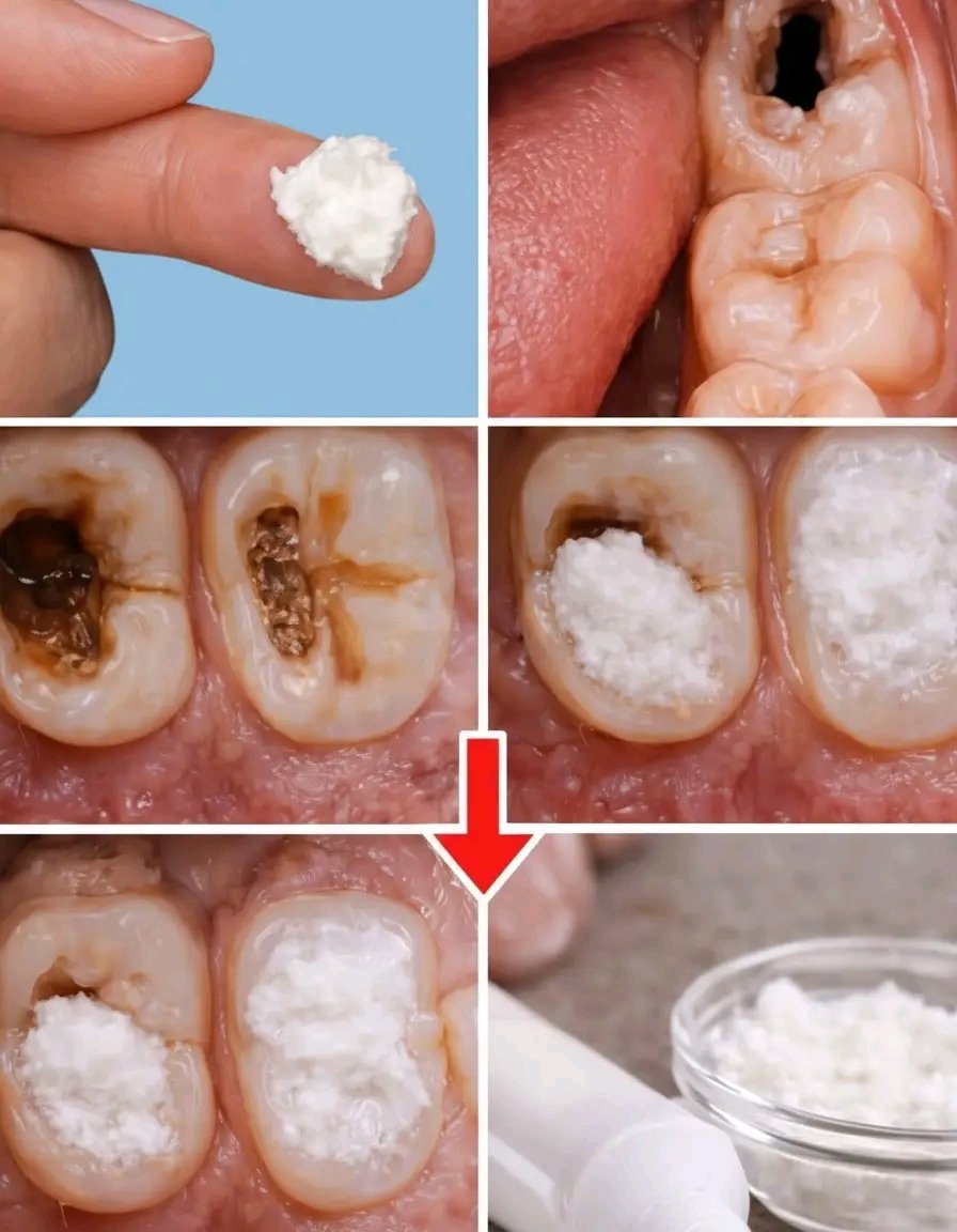 AgriVision2050's tweet image. Keep these tips in mind to avoid visiting the dentist How to naturally repair a cavity