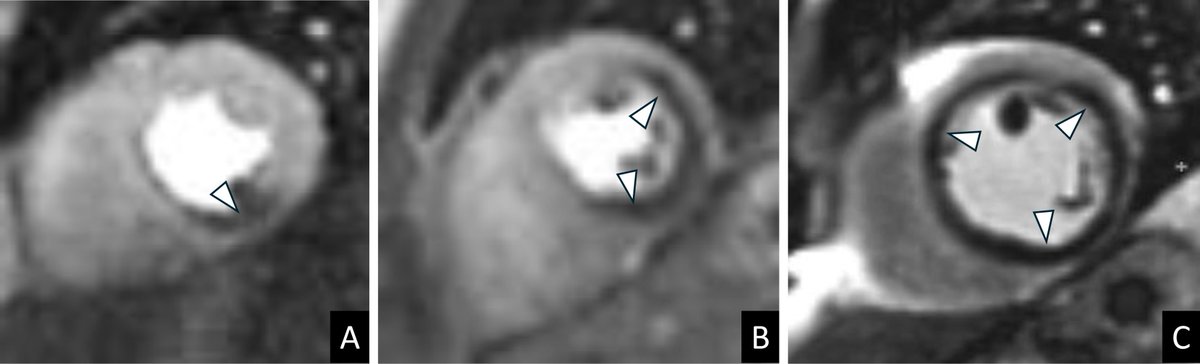 @RevistaRADIOLOGIA tweet media