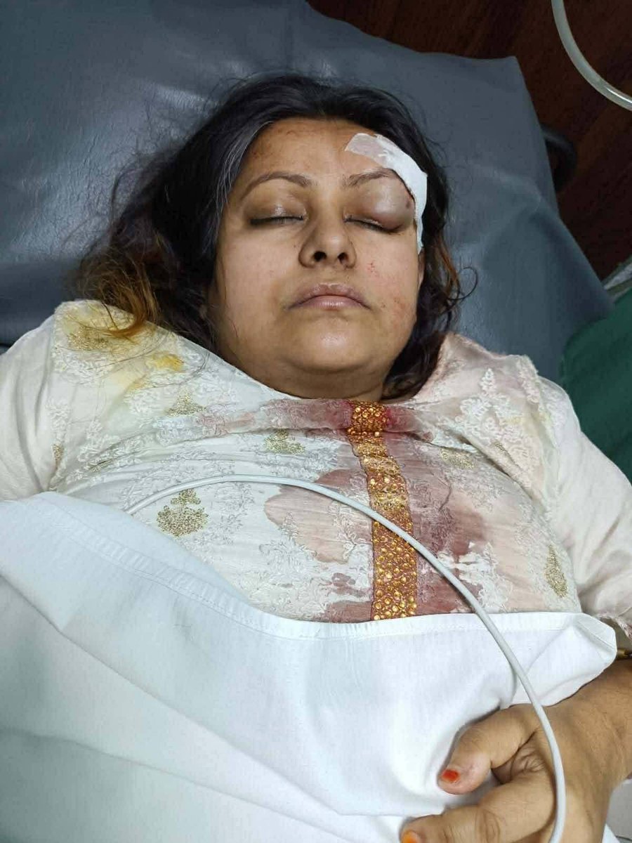 MAarafat71's tweet photo. Terrorists have attacked Zainab Binte Hossain, Assistant Professor of the Bangla Department at Bangabandhu Sheikh Mujibur Rahman Science and Technology University.

It is noteworthy that some time ago, the university administration had warned her regarding her writings because of her work on Bangabandhu and the Liberation War.

We strongly condemn and protest this attack.