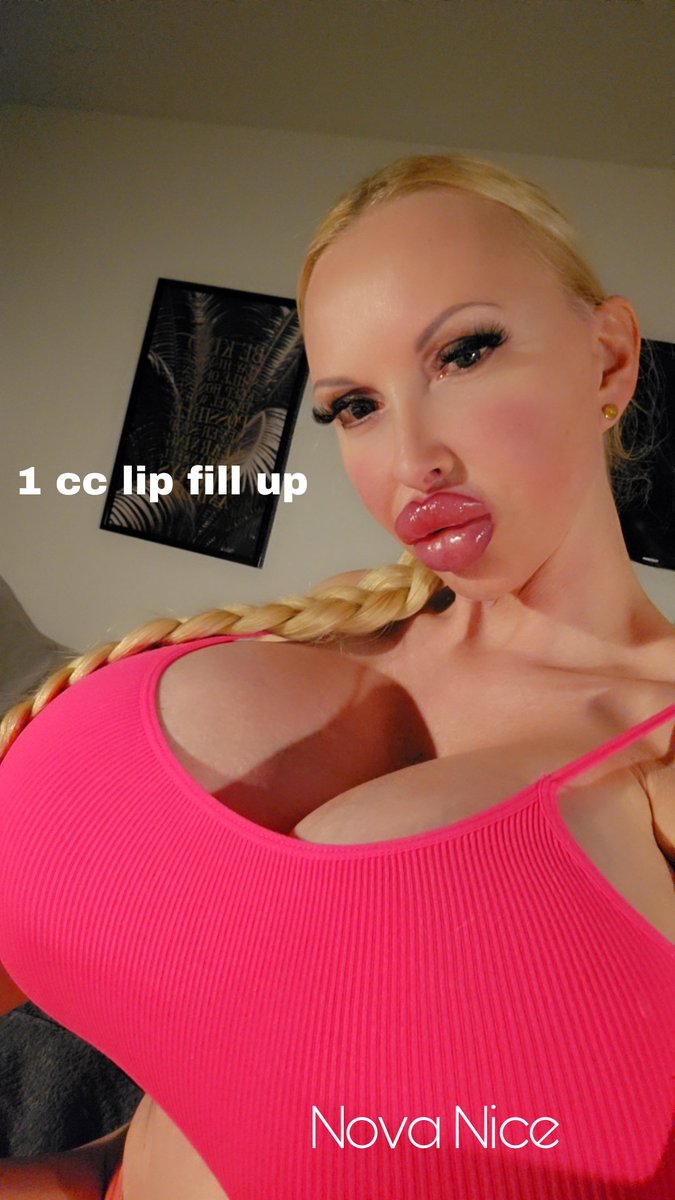 Everything nice and round now. 
I love it. You too?
#boobs #bigboobs #xxlboobs #butt #barbie #silicone #expander #novaniceofficial #RealNovaNice #lips #4180cc #siliconebutt #bestfansoriginal