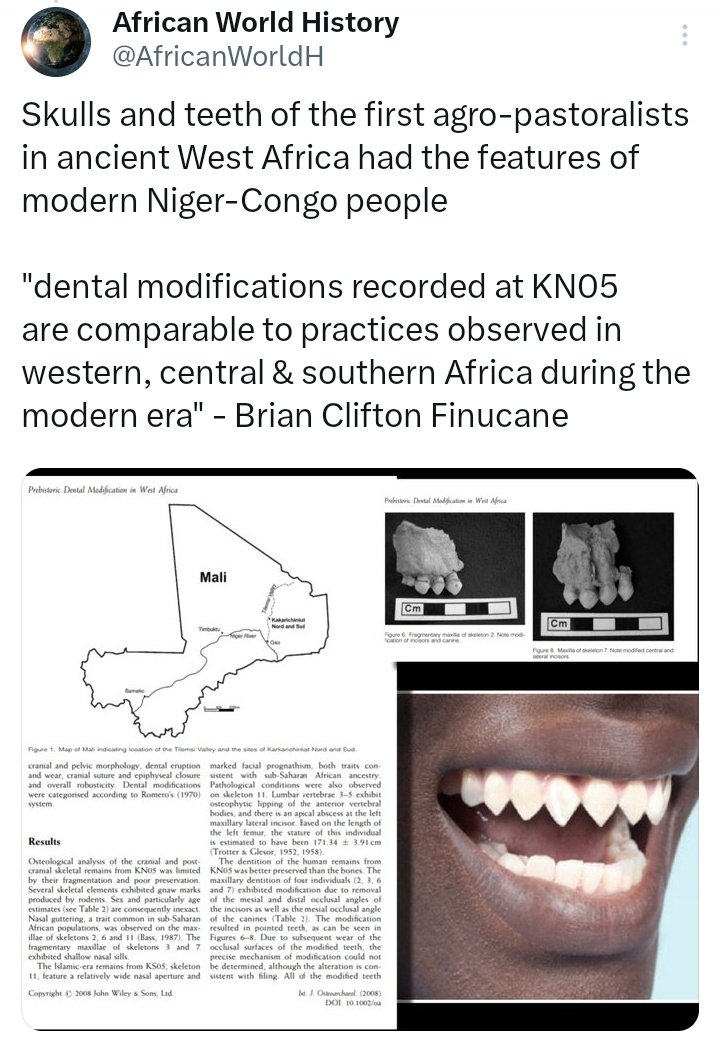 Ancient West African Aesthetic
(Teeth Modification, Hierarchical Jewelry And Panther- Lion Skin Clothing In Ancient West Africa)

Panther and lion skin clothing were first worn in ancient Western Africa during the time of the paleolithic Aterians (120,000 years ago), it was later