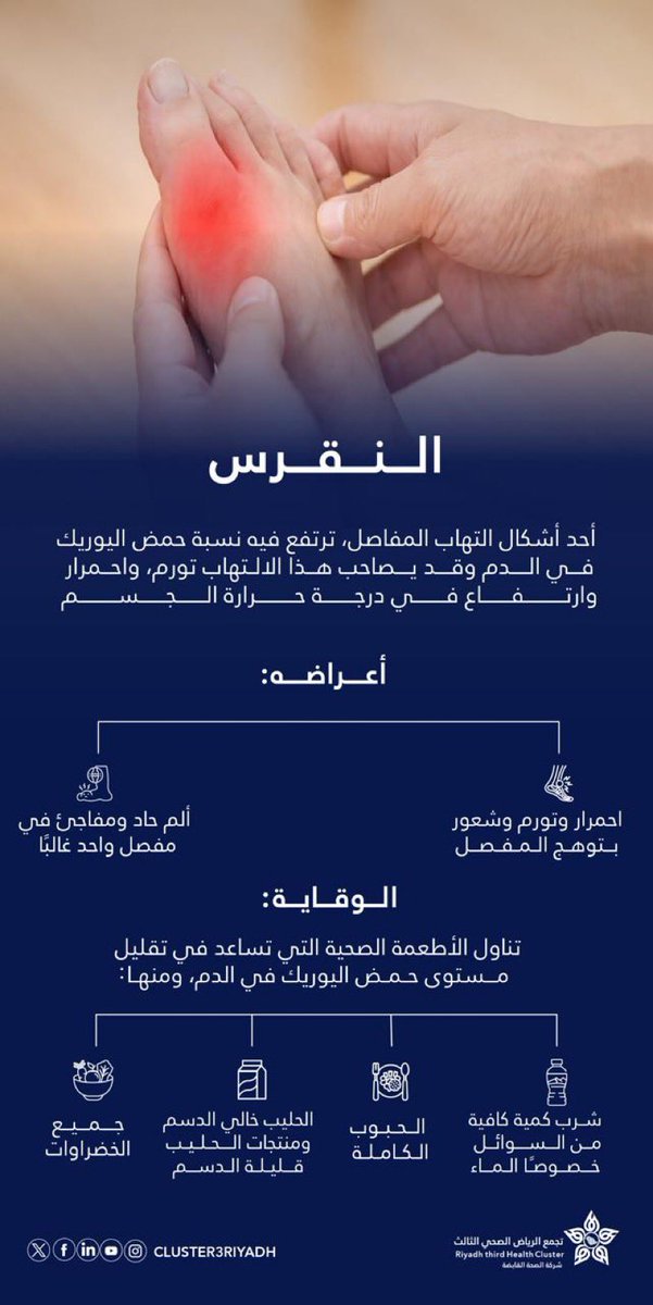 💡| النقرس أحد أشكال التهاب المفاصل، يسببه ارتفاع حمض اليوريك..

تعرّف على أعراضه وطرق الوقاية ⬇️

#معلومة_تهمك 
#تجمع_الرياض_الصحي_الثالث