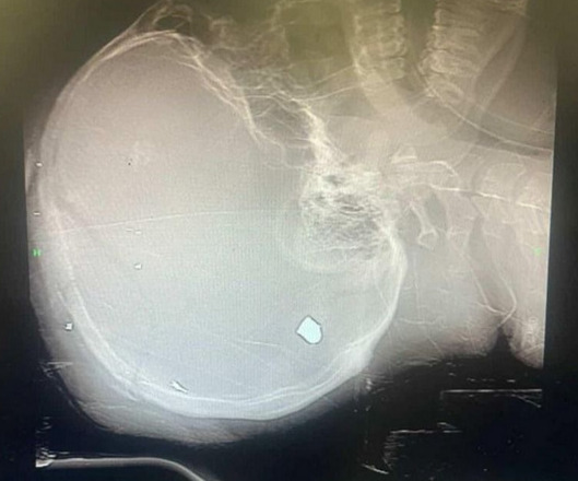 ayatsubzero's tweet photo. A message from a passenger who just left Iran: "This protester was shot and killed in the head with a 9mm pistol by security forces. They are on a rampage as if taking revenge."
- The person was murdered on January 9th.
- I cropped the image to conceal the identity and location. https://t.co/G95nxTcEgl