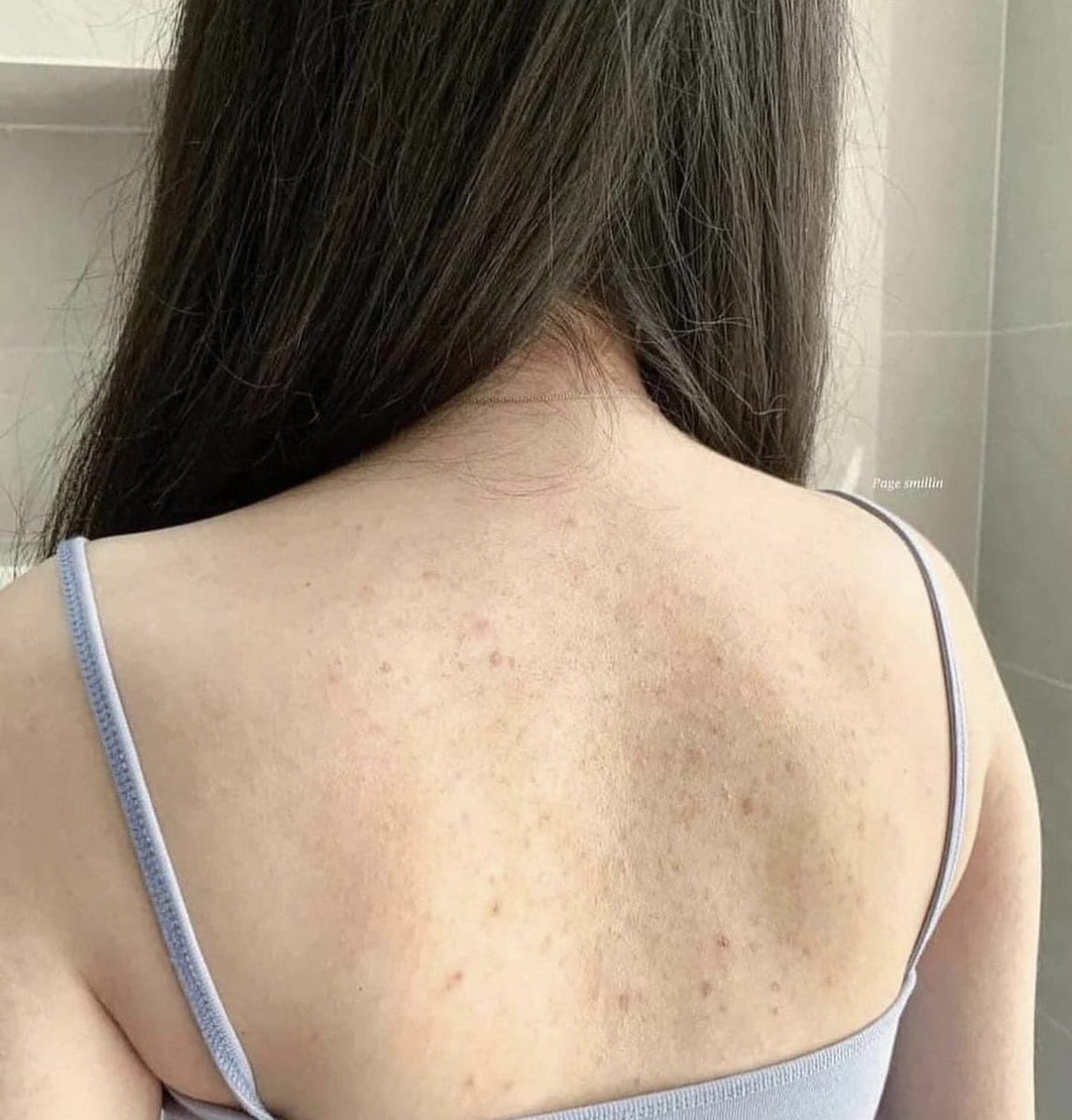 الصابون اللي بينسيك حبوب الظهر ويصفيه لك ويقشعها قشع ، اللي عندها اكزيما والصوابين ماتناسبها استخدميه وانتي مرتاحه لان كل مكوناته عضويه وطبيعيه وامنه عالبشره 🤎