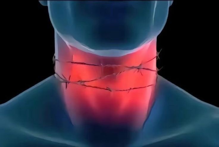 miyarah_'s tweet image. yo cuando digo que la comunicación es clave pero soy incapaz de expresar cuando algo me molesta o me incomoda