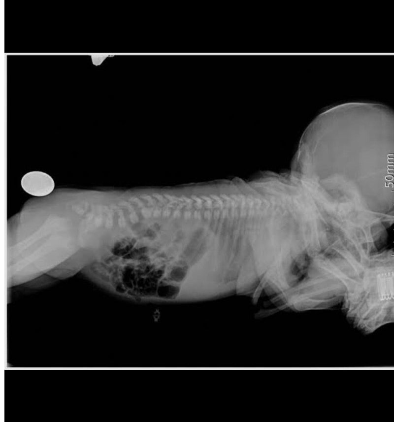 What's your diagnosis and what investigation is this.....