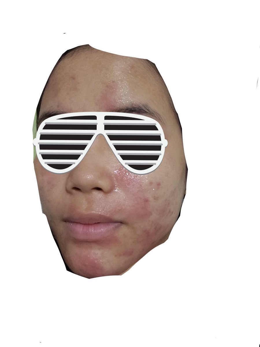 Poskokkn's tweet photo. @ohmy_beautybank Teratu lightweight moisturizerrrrr
Sumpah itu moist penyelamatku dari yang kaya gini, jadi better https://t.co/0DUTDrxGVW