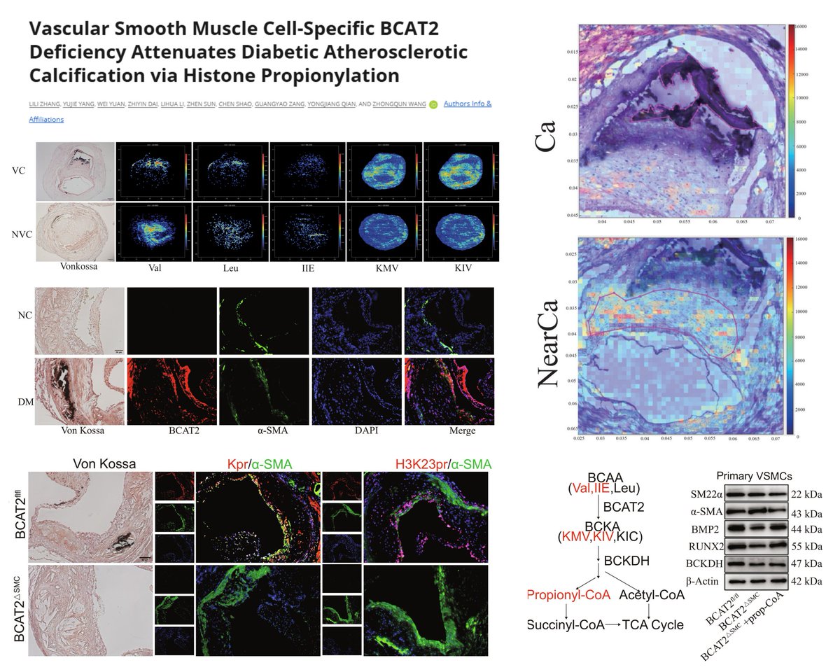 HaoYin20's tweet photo. #BranchedChainAminoAcid #Diabetes #Atherosclerosis #Calcification
#SpatialMetabolomics #MassSpecImaging calcified 👤anterior tibial artery➡️
⏫BCAA metabolism
Propionyl-CoA, the product of BCAA catabolism, ▶️Histone Propionylation (H3K23, not H3K14/18/56) & Smooth Muscle Cell Osteogenesis
SMC BCAT2 KO, or BAY-069 (BCAT2i) in Apoe-/-🐭 +HFD +STZ➡️
⏬aortic lesional H3K23Pr (Appears affecting more than SMCs🧐) & Calcification
Any other lesion features altered?🥸
Research 2026
https://t.co/mbXzl4Mi8g