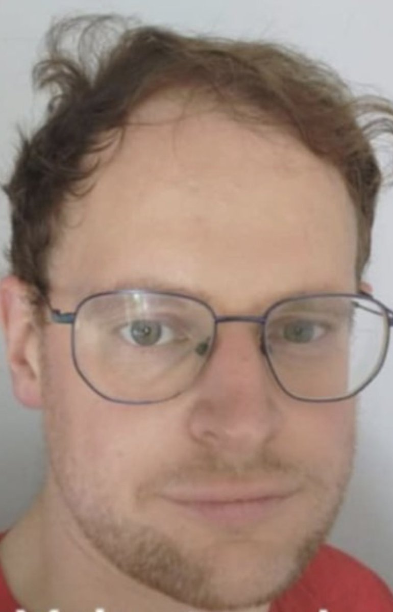 goalpostsbaker's tweet image. Look at the fucking hairline on @TitchPencader 😂😂😂😂 spends all day trolling on twitter and turns out he’s downs