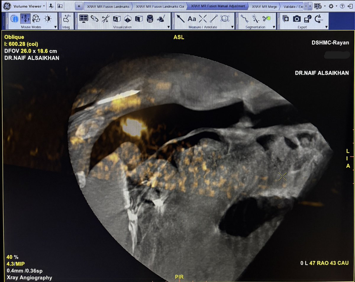 Mohammed Y. Alateeq | محمد بن يوسف العتيق tweet media