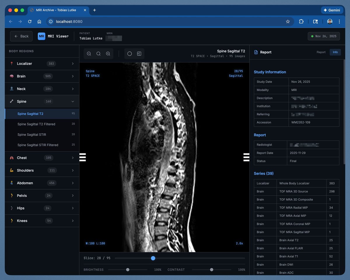 MRI viewer app screenshot