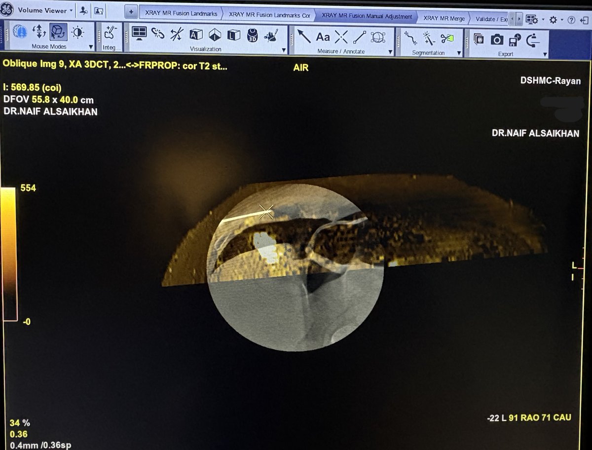 Mohammed Y. Alateeq | محمد بن يوسف العتيق tweet media