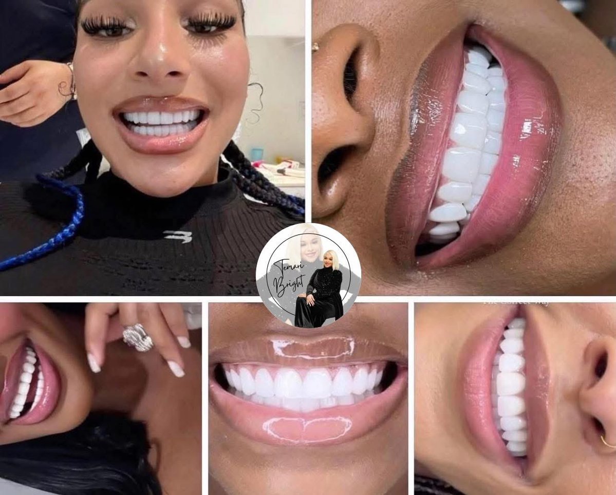 _Mulaamamii's tweet image. What’s on your mind ? 
Me: getting my teeth done 😩😂🦷