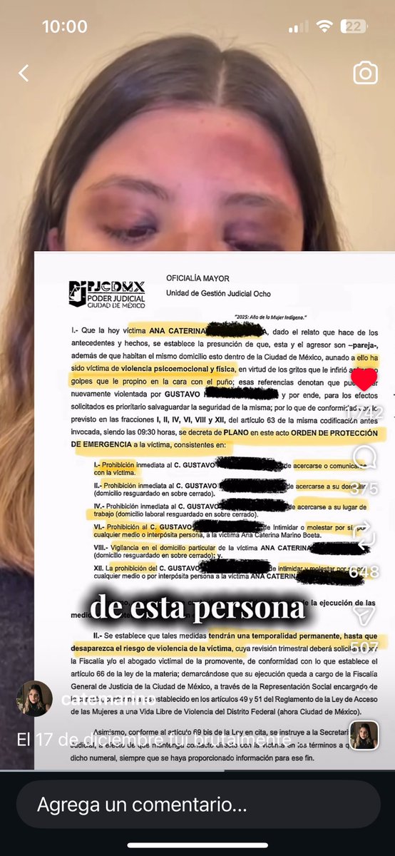 JuanPabloFdz's tweet image. Ella es Ana Caterina y ya puso una denuncia contra el cobarde de su ex-novio Gustavo “N”, que la golpeó de forma brutal, en lo que constituye un intento de feminicidio. Le tienen que dar 17 años de cárcel como al “fofo” Márquez. Actúen ya, qué esperan @FiscaliaCDMX? RT porfa.
