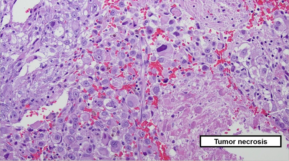 Dr. Bui Pathologist🌼 tweet media