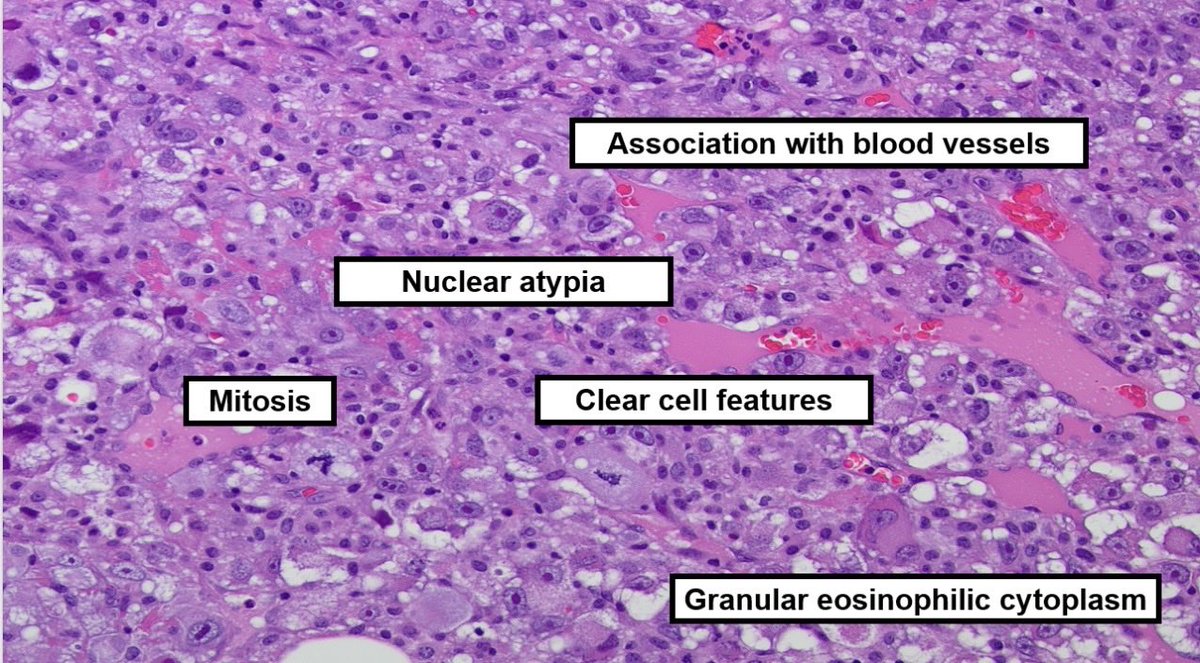 Dr. Bui Pathologist🌼 tweet media