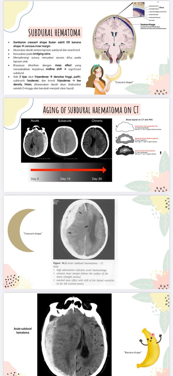 aestheticnotes's tweet image. 💌 RADIOLOGY PACKAGE!

materi pembelajaran radiologi terlengkap, start from the basics, radiologi thoraks, abdomen, muskuloskeletal, special cases radiologi pediatrics, head ct-scan, usg abdomen. lengkap dgn ilustrasi kasus, pdf &amp;amp; video akses lifetime! only 80k dm jika berminat