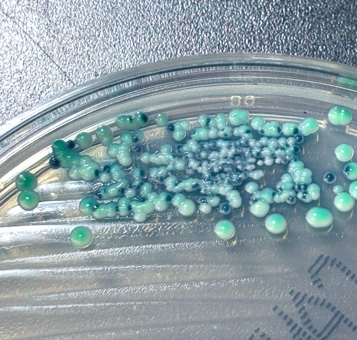 candyca88328815's tweet photo. Candida albicans 上気道
どちらもalbicans. Candida属菌は日和見感染や医療関連感染の原因となる. ���体外でも生存可能. 健康成人40～60% の消化管,口腔内で検出. 菌血症分離頻度が高く致死率30～50%程度と高い. 血流感染,関節炎,骨髄炎,眼内炎,心筋炎,心膜炎,CIED感染,髄膜炎,腹膜炎,筋炎などがある. https://t.co/a9VgCDPrNz