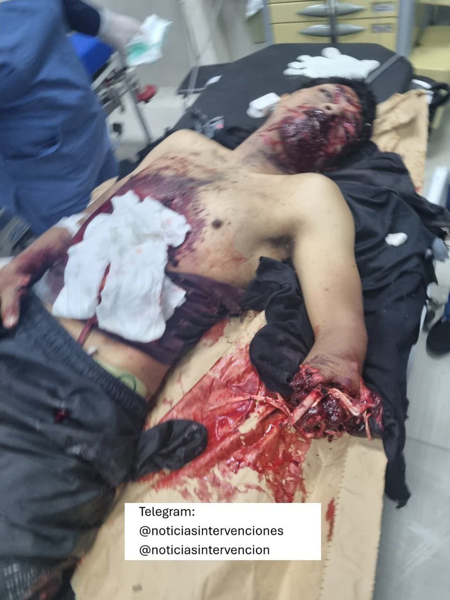 Intervencion Policial tweet media