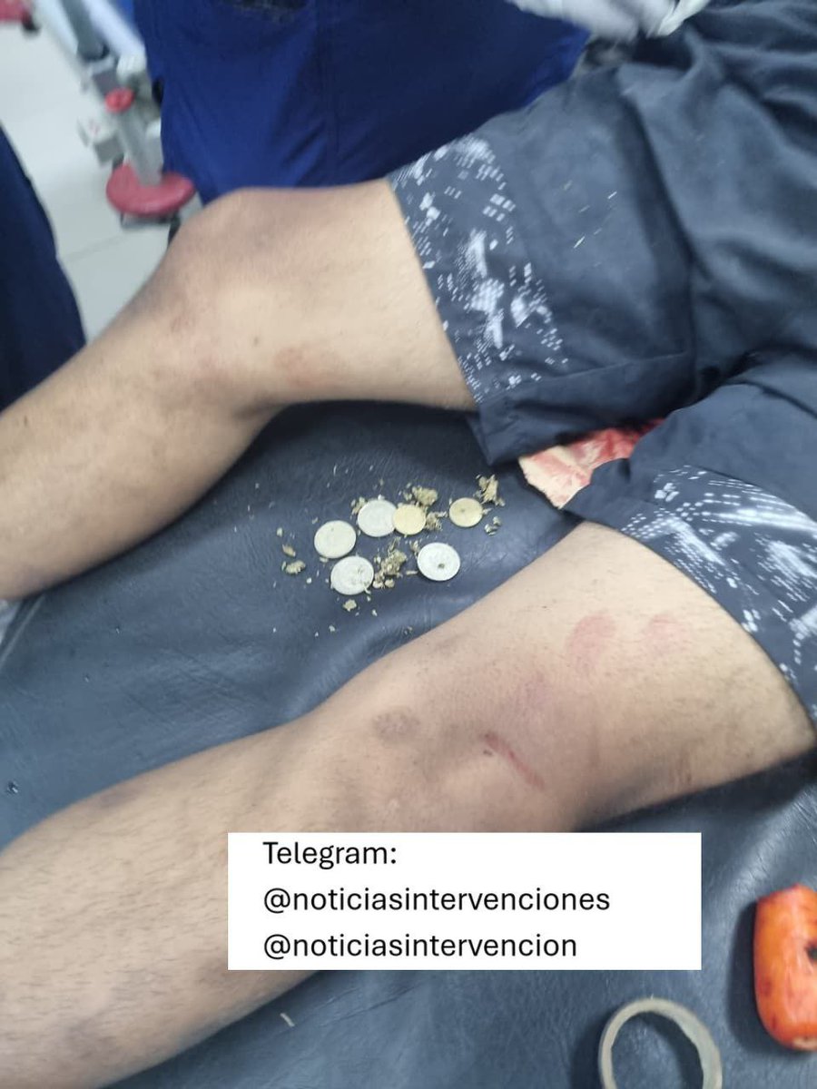 Intervencion Policial tweet media