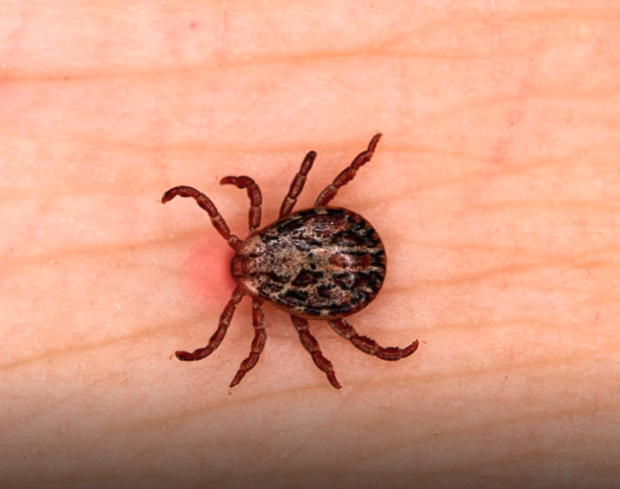 ใครไปเที่ยวญี่ปุ่นระวัง! ผู้ป่วยโรคเห็บ พุ่งสูงสุดเป็นประวัติการณ์ เสี่ยงอวัยวะล้มเหลวถึงเสียชีวิต

12 ม.ค. 2569 เตือนคนที่จะไปเที่ยวญี่ปุ่นให้ระวัง โรค SFTS (Severe Fever with Thrombocytopenia Syndrome) หรือ โรคไข้รุนแรงร่วมกับเกล็ดเลือดต่ำ ซึ่งติดต่อผ่านเห็บ (tick-borne