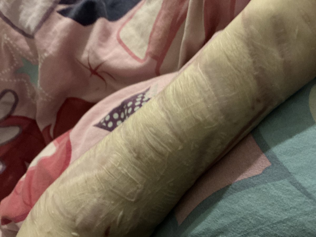 I’m turning yellow