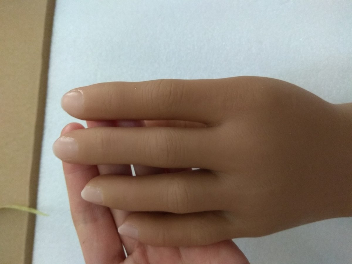 #orthotics #prosthetics #ortesis #prosthesis #Ortopedia #Orthopedic #AFO #kakipalsu #Протезирования #протезыног #Aplusorthotic #Aplusprosthetic